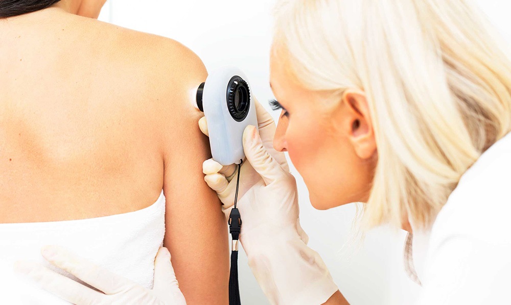 Guide to Understanding Moles and the Right Time to See a Doctor